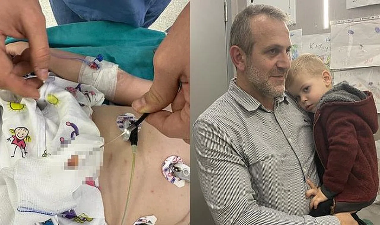 2 yaşındaki çocuk 1,5 aydır öksürük nöbeti geçiriyordu! Sebebi akciğerindeki fındık çıktı