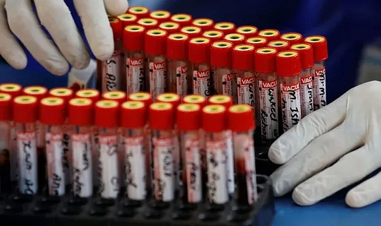 Bir Adım Ötesini Düşünmeyen Kan Grubu Açıklandı: Risk ve Heyecana Balıklama Dalıyorlar!
