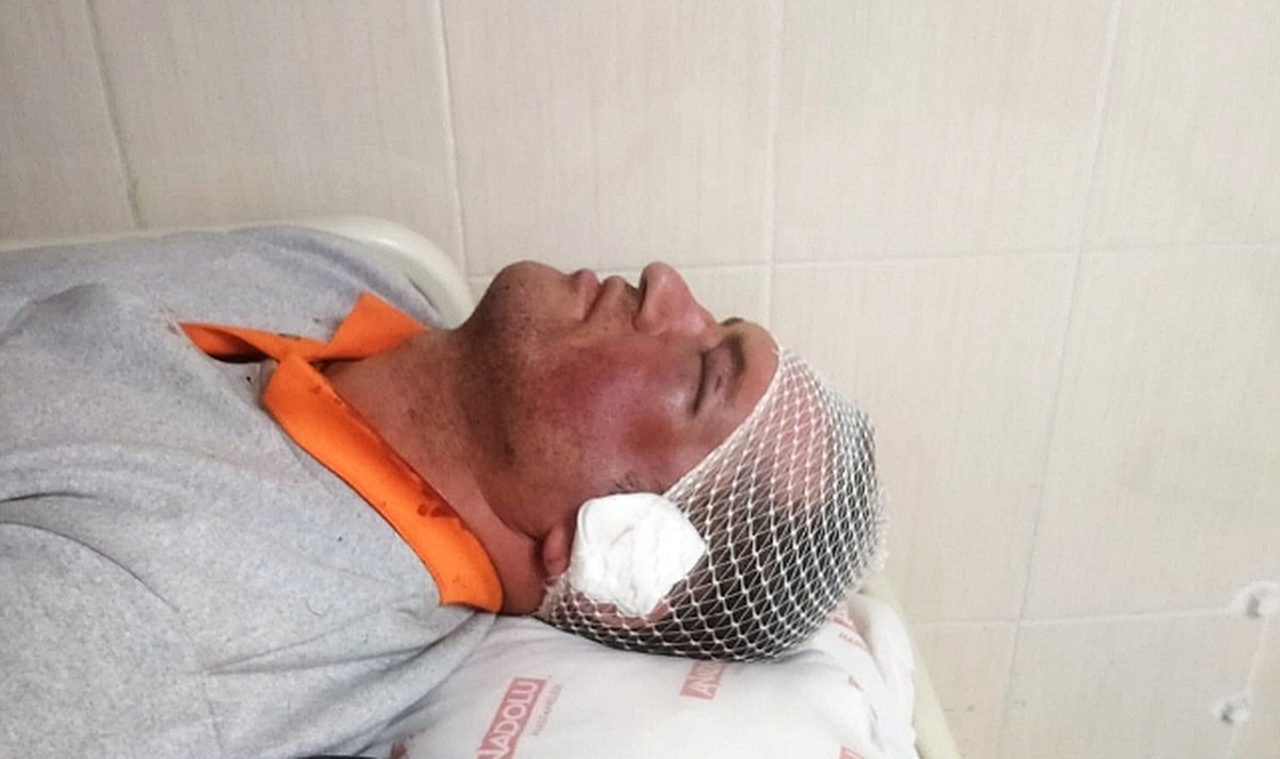 Temizlik işçisi saldırıya uğradı... Belediyeden sert tepki!