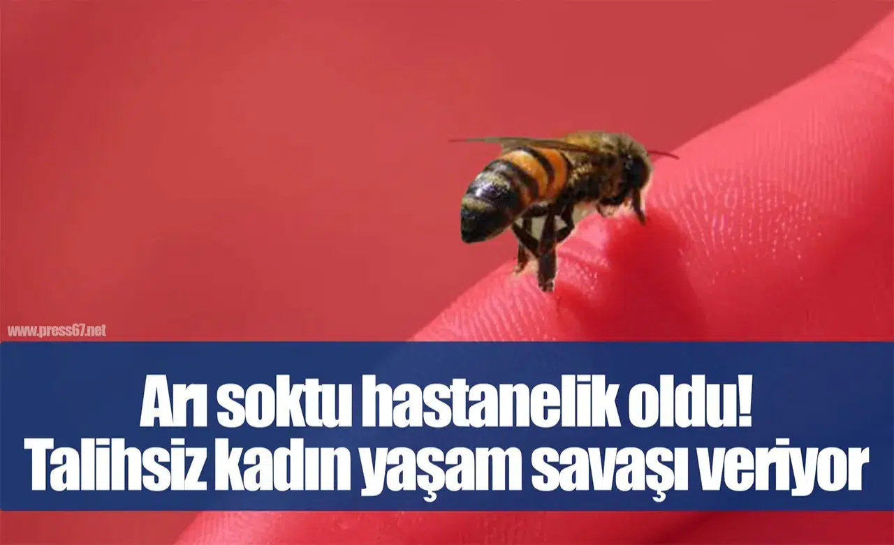 Zonguldak'ta Fındık Bahçesinde Eşek Arısının Soktuğu Kadın Yoğun Bakıma Alındı