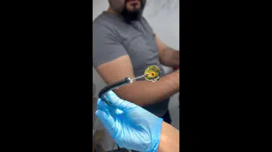 Dört yıldır kusma şikayeti çeken kedinin midesinden buzdolabı vakumu çıktı