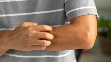 Onkolog Amit Garg uyardı kaşıntı sinsi kanserlerin belirtisi olabilir