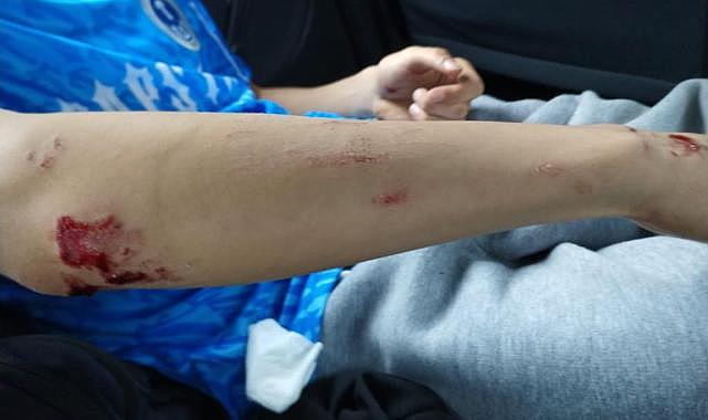 Sahipsiz köpekler hastanelik etti