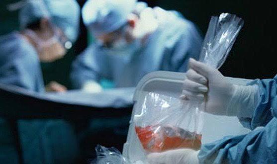 Ölen kadının organları 3 kişiye can oldu