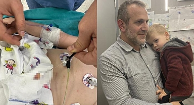 2 yaşındaki çocuk 1,5 aydır öksürük nöbeti geçiriyordu! Sebebi akciğerindeki fındık çıktı