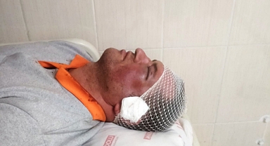 Temizlik işçisi saldırıya uğradı... Belediyeden sert tepki!