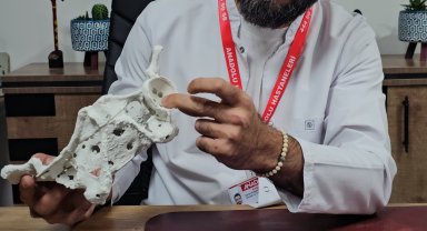 60 yaşındaki kadın 3D yazıcıyla üretilen kalça proteziyle sağlığına kavuştu