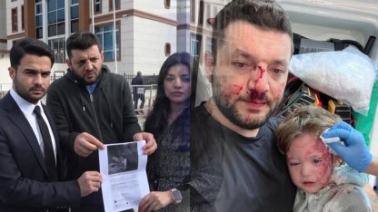 Yalova'da 14 aylık bebeğin yaralandığı saldırıda pes dedirten savunma: "Amacım babasına vurmaktı, fırlattığım cisim..."